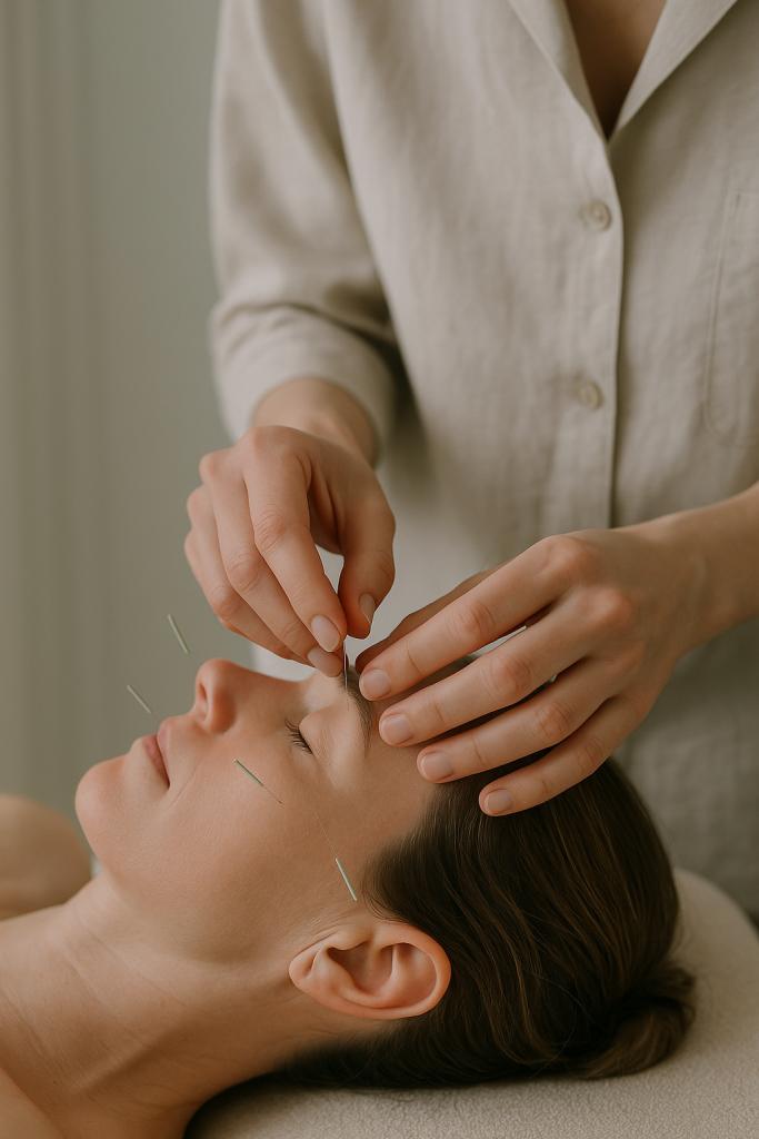 Acupuntura estética